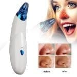 Aqua Peel Black Head Tool (2)