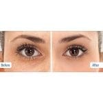 Dark Circles Serum Treatment Heaven Dove Cream