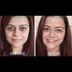 Dark Circles Serum Treatment Heaven Dove Cream