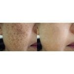 Truskin Naturals C Vitamin C Serum (3)