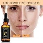 Radha Beauty Vitamin E Serum New