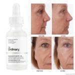 The Ordinary Hyaluronic Acid 2% + B5 (4)