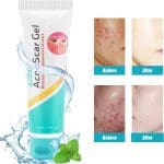 Laoshi Acne scars gel 8